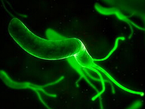 哪些因素影响幽门螺杆菌根除？