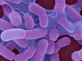 限制经验性使用环丙沙星能否改善药物敏感性?