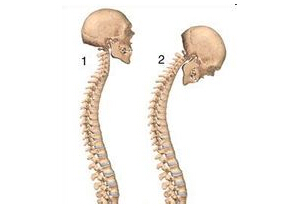 csDMARD合成药与AS和uSpA患者TNFi治疗5年有效相关