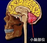 小脑深部核团T1加权信号:钆双胺优于钆特酸葡甲胺