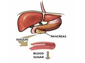 筛查T2DM有用吗？
