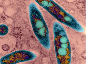 低剂量庆大霉素治疗儿童非复杂性粪肠球菌菌血症可能弊大于利