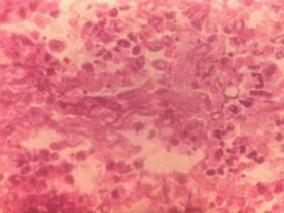 糖皮质激素治疗败血症:荟萃分析与试验序列分析的系统评价