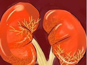 碘克沙醇或为需要动脉内给药的慢性肾病高危患者的最佳选择