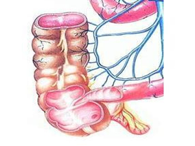 急性单纯性阑尾炎：抗菌药物vs阑尾切除术