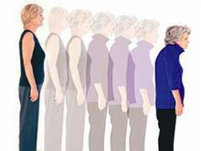 特立帕肽治疗女性骨质疏松：每天用药与周期性用药等效