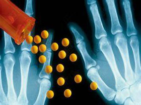 抗TNF-α治疗能改善儿童克罗恩病患者的骨小梁BMD和皮层结构