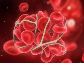 左旋甲状腺素可缓解亚临床甲减患者的血栓前状态