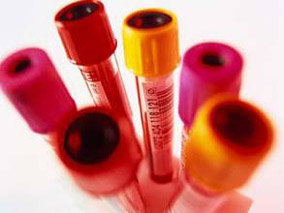 慢性ITP新的联合疗法显示出前景