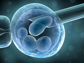 使用枸橼酸克罗米酚的温和卵巢刺激法是体外授精的有价值的选择