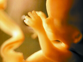 脐带长度与风湿性心脏病的关系