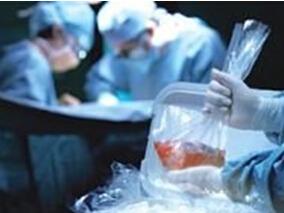 DCD后肾移植：抗胸腺细胞球蛋白能降低DGF时间和急性排斥率