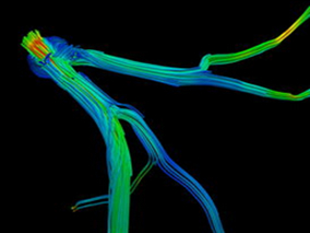 CCTA检查：“双低”碘克沙醇方案可保持冠状动脉图像质量