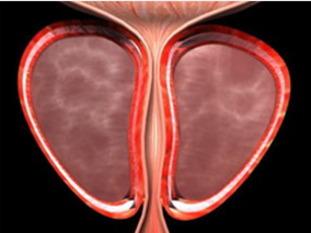 静注钆双胺能进入前列腺上皮细胞和腺腔有助于前列腺DCE-MRI检测