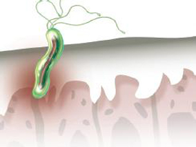 根除幽门螺杆菌 哪种疗法比较好？