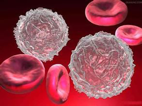 新发骨髓瘤治疗的III期试验:VCD方案vs PAd方案