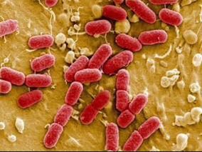 广谱-β内酰胺酶大肠埃希菌菌血症：CF或可替代亚胺培南