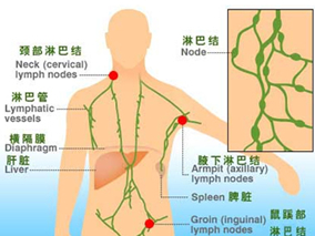 双重打击淋巴瘤:一线增加剂量免疫化学疗法使患者获益