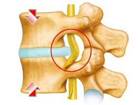 哪种含碘对比剂对人椎间盘细胞的细胞毒性最小？