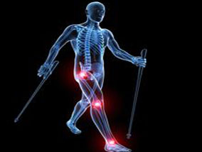 RA患者依那西普用药策略：全剂量、减量或中止用药