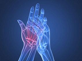 风湿性关节炎“达标治疗”的系统性证据更新