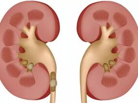 利妥昔单抗治疗复发性/难治性狼疮肾炎 4倍剂量没必要？