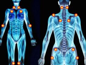 普瑞巴林治疗成人纤维肌痛的有效性和不良事件