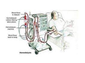 需要透析的患者使用盐皮质激素 获益和危害不确定