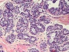 男70岁，怕热、多汗、抑郁、粒细胞减少、房颤