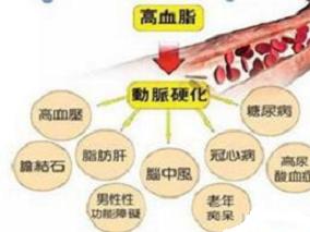 原发性高胆固醇血症：依折麦布+瑞舒伐他汀vs瑞舒伐他汀
