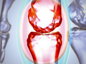 TNF-α抑制剂生物类似物与生物仿制药的生物等效性