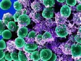 碳青霉烯类治疗期间突破性GNB的临床特征和危险因素