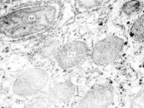 男56岁，左侧胸肋部、腰部及右下肢疼痛1年