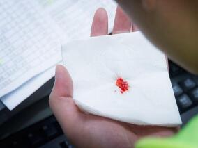 氨甲环酸能有效治疗咳血？