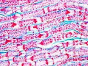 如何治疗糖尿病周围神经病变?