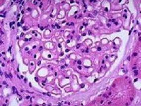 男48岁，发现尿糖阳性半个月，但血糖正常