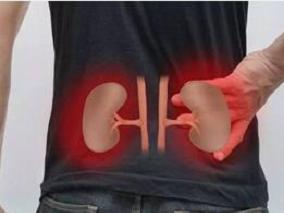 男23岁，全程肉眼血尿2天，病情稳定出院6个月后复查再住院