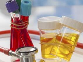 血尿8个月,乏力1个月,贝那普利等治疗无效果