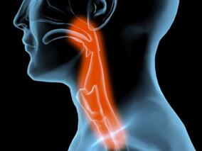 男47岁,2月余前无明显诱因出现吞咽困难,不伴恶心呕吐