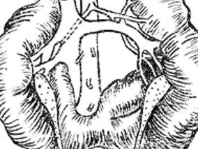 女48岁，间断手足麻木、抽搐2年，偶有双下肢水肿