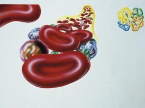 服用氯吡格雷的冠心病患者换药 选择普拉格雷还是替格瑞洛？