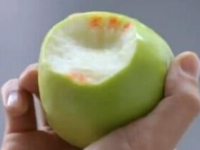 青年女性,发热、乏力、皮肤瘀斑3周,伴牙龈出血2天,三系减少原因待查