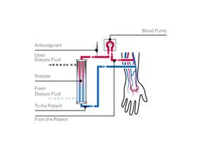使用RCA-CVVH的危重病患者中头孢呋辛的群体药动学