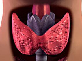 女69岁，怕冷、少语、反应差25年，活动后气短伴头昏3月余，是甲减吗？