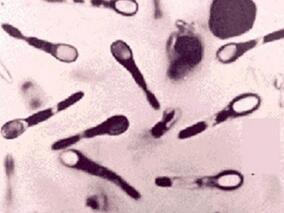 上一位病床使用者接受抗生素会增加下一位患者CDI风险？