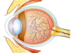 贝伐珠单抗和兰尼单抗对nAMD患者的疗效相当