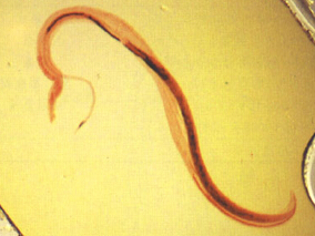 吡喹酮治疗妊娠期血吸虫病的有效性和安全性