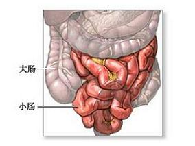 小肠粘膜保护：塞来昔布单药vs洛索洛芬+兰索拉唑