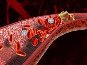 静脉血栓栓塞：达比加群vs达肝素钠
