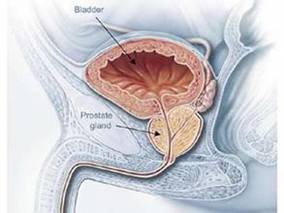 激素敏感前列腺癌：标准治疗联合多西他赛或双膦酸盐是否更有效？